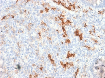 Anti-NGF Receptor / p75NTR / CD271, clone NGFR/1997R