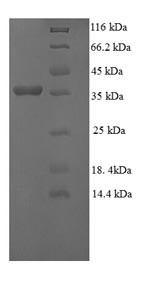 Gamma-glutamylcyclotransferase (GGCT), human, recombinant