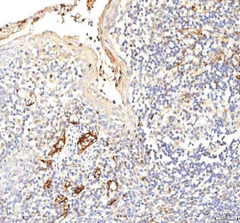 Anti-Plakophilin 2 / PKP2