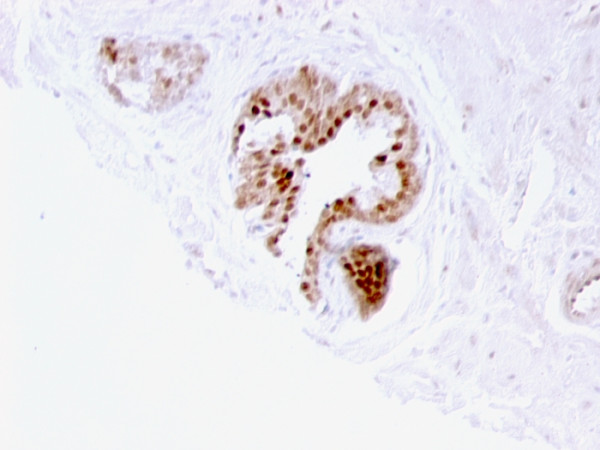 Anti-p57Kip2 (Mitotic Inhibitor/Suppressor Protein), clone 57P06