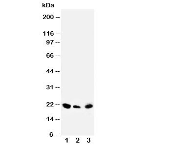 Anti-DUSP3
