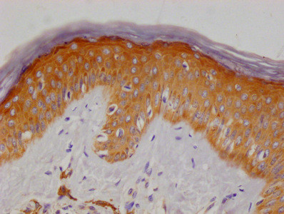 Anti-MERTNL Monoclonal, clone 1F7A6