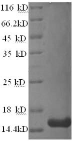 Tetraspanin-7 (TSPAN7), partial, human, recombinant