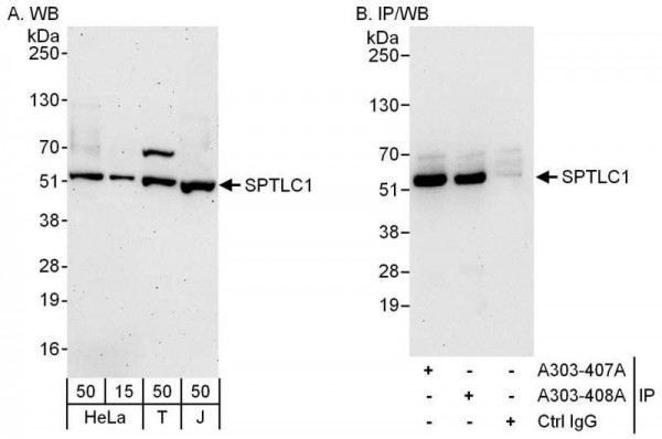 Anti-SPTLC1