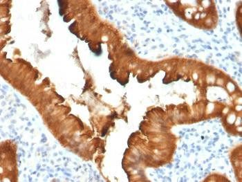 Anti-Villin (GI-Mucosal &amp; Urogenital Brush Border Marker) Monoclonal Antibody (Clone: VIL1/2376)