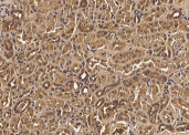 Anti-VEGF/VEGFA Monoclonal Antibody