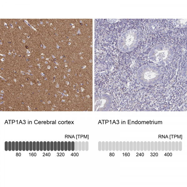 Anti-ATP1A3