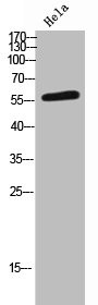 Anti-CCT7