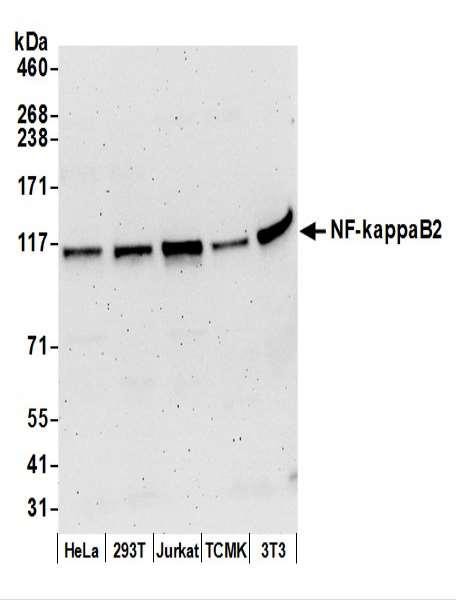 Anti-NF-kappaB2