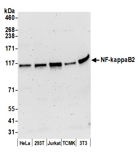 Anti-NF-kappaB2