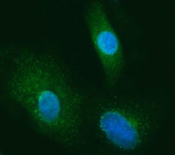 Anti-SEC13 / SEC13L1 / SEC13-like protein 1