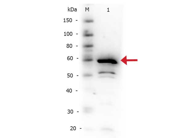 Anti-IkappaBalpha, CT (IkBa)