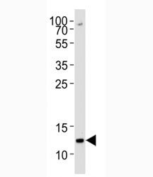 Anti-methyl-Histone H4 (Methyl-Lys20 specific)