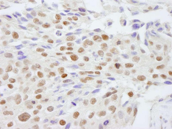 Anti-SAFB2 (IHC)