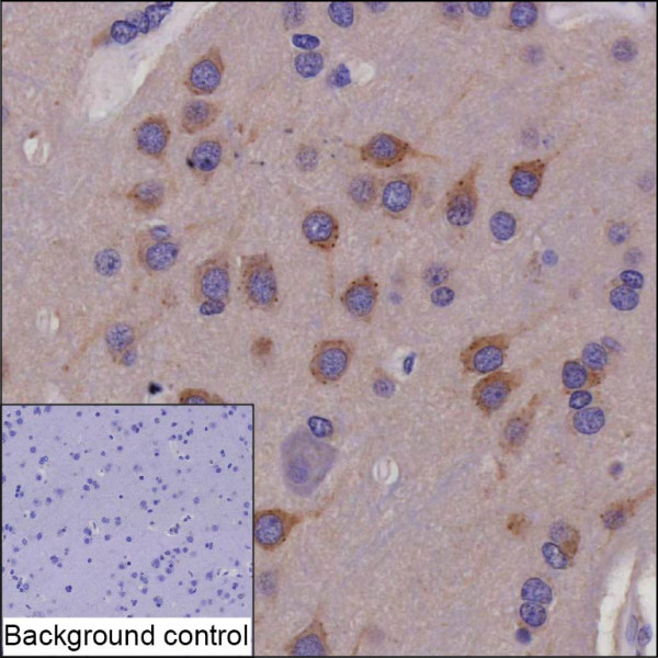 Anti-PRKAR1B