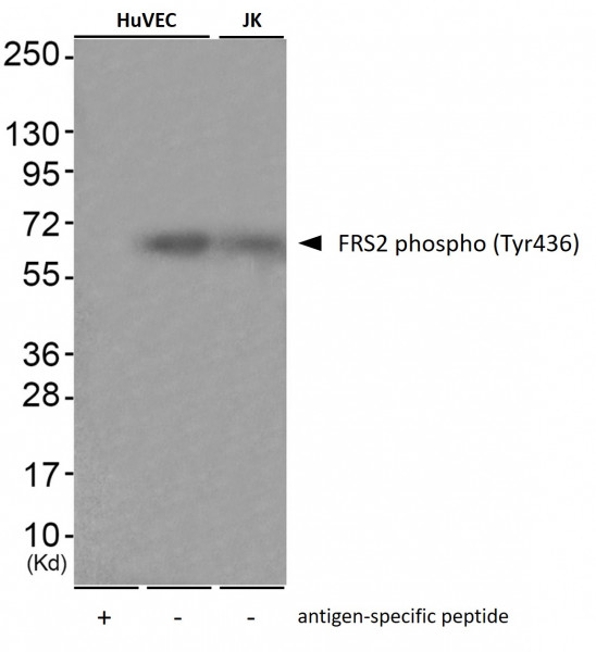 Anti-phospho-FRS2 (Tyr436)