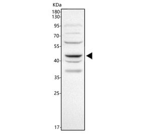 Anti-WNT5A