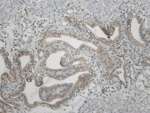 Anti-Recombinant Raf-1 (Phospho Ser259), clone C111865