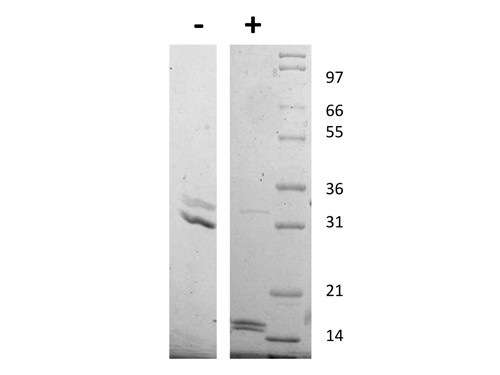 Interleukin-17AF Heterodimer