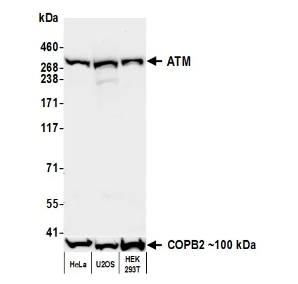 Anti-ATM Recombinant Monoclonal