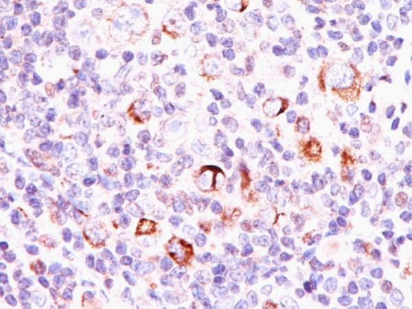 Anti-Bcl-X (Apoptosis Marker), clone SPM337