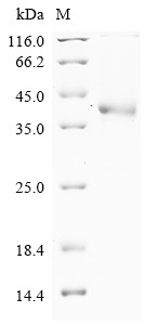 Trypsin-1 (PRSS1), partial, human, recombinant