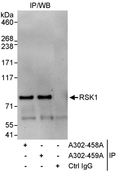 Anti-RSK1