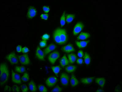 Anti-TRPM3