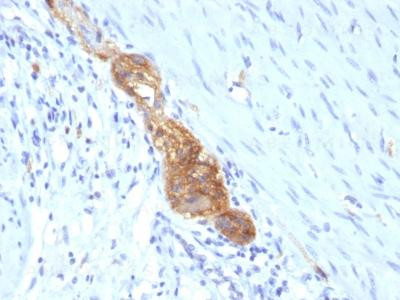 Anti-CD56 / NCAM1 / NKH1 (Neuronal Cell Marker)(Clone: SPM489)