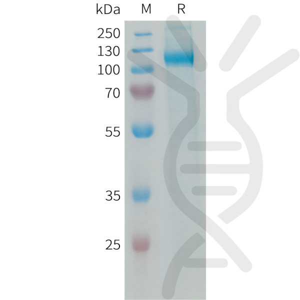 Human AOC3 Protein, His Tag
