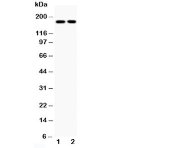Anti-Topoisomerase II alpha