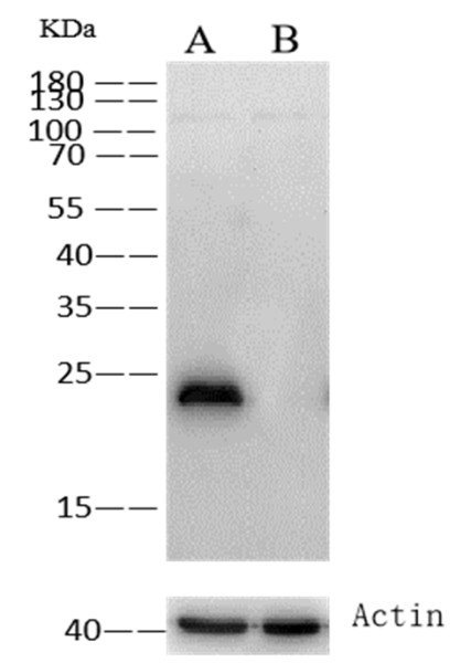 Anti-GSTP1 Monoclonal Recombinant Antibody