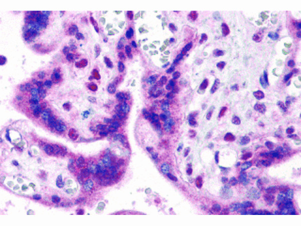 Anti-IRF2BP2