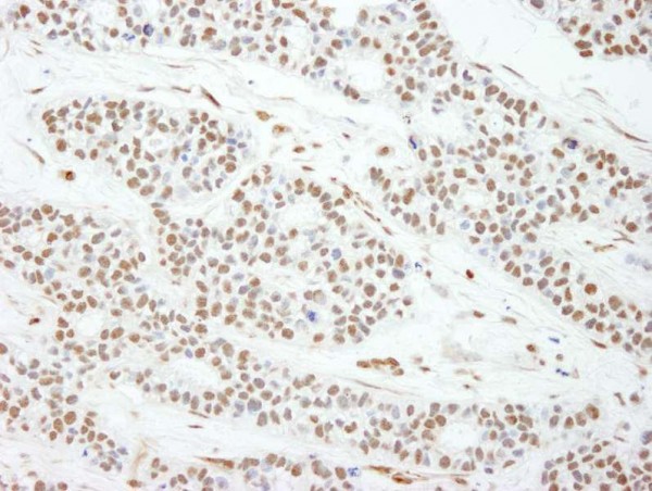 Anti-MAD2 (IHC)