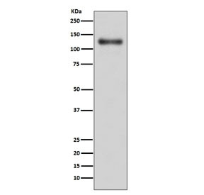 Anti-LAMP1 / CD107A, clone IIB-12