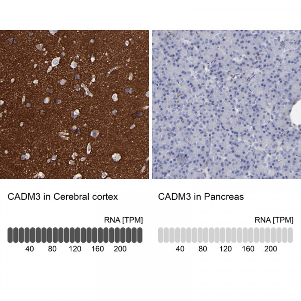 Anti-CADM3