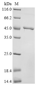 Kinesin-like protein KIF18B (KIF18B), partial, human, recombinant