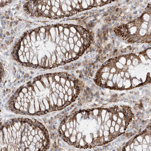 Anti-COLGALT2