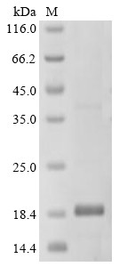 Aquaporin Z (aqpZ), partial, Shigella flexneri, recombinant