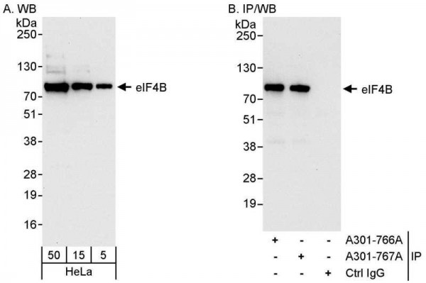 Anti-eIF4B