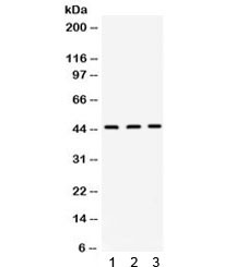 Anti-Orosomucoid 1 / ORM1