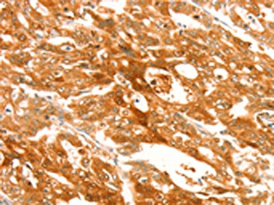 Anti-TRPM7