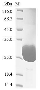 Gastrin-releasing peptide (GRP), partial, human, recombinant