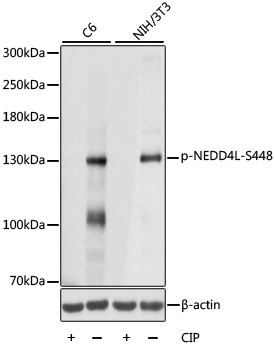 Anti-phospho-NEDD4L (Ser448)