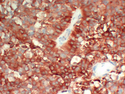 Anti-FSH / Follicle Stimulating Hormone