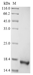 Amelogenin, Y isoform (AMELY),partial, human, recombinant