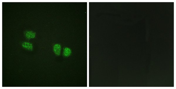 Anti-phospho-DDX5 / p68 RNA helicase (Tyr593)