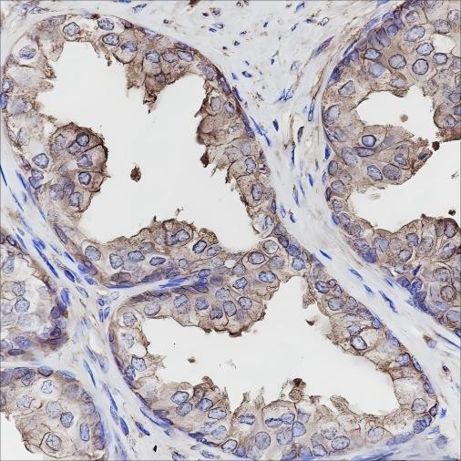 Anti-Recombinant Calpastatin, clone A149