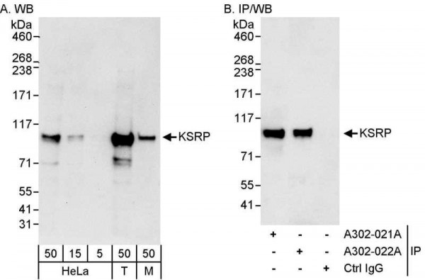 Anti-KSRP