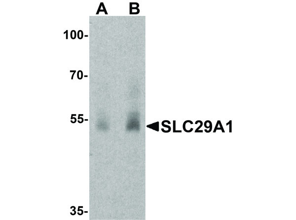 Anti-SLC29A1